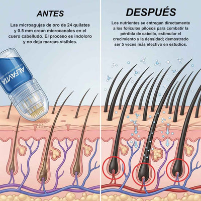 Alfavita™ Sistema Regeneración Capilar (2 meses)