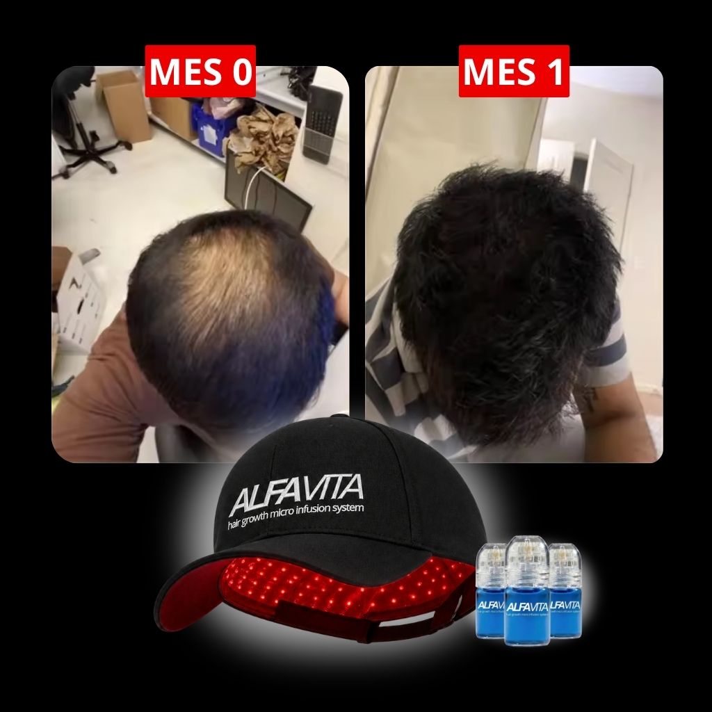 ACELERA TUS RESULTADOS - GORRA TERAPIA LUZ ROJA