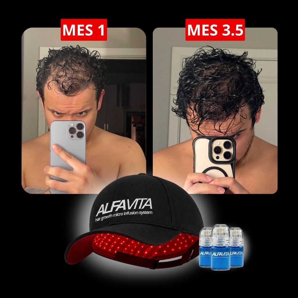 ACELERA TUS RESULTADOS - GORRA TERAPIA LUZ ROJA